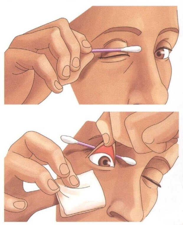 Как почистить глаз