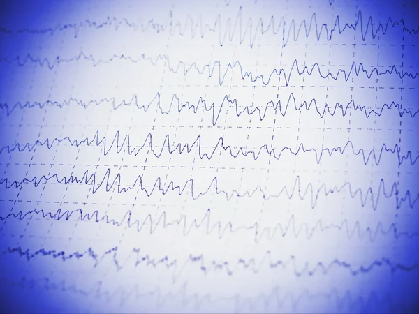 Красный граф мозга волны ЭЭГ — стоковое фото