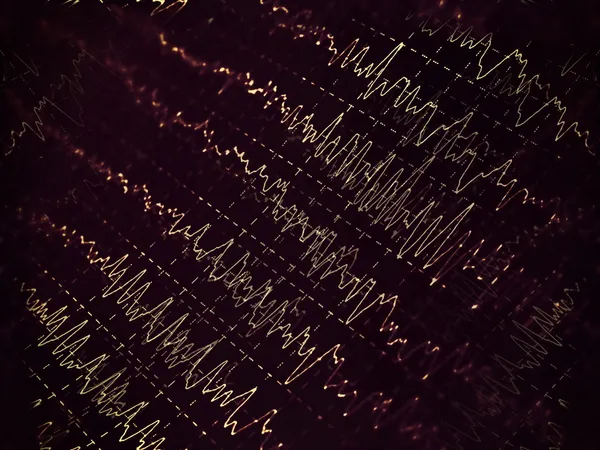 Мозг волны на электроэнцефалограмма — стоковое фото