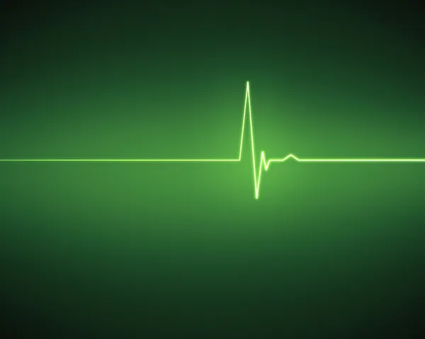Зеленый ЭКГ сердцебиение — стоковое фото