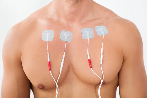 Человек с электродами на груди — стоковое фото