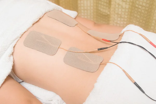 Десятки терапия, электроды десятков устройство на мышц спины — стоковое фото