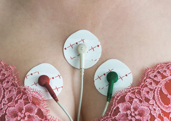 Электроды холтеровское мониторирование на груди женщины — стоковое фото