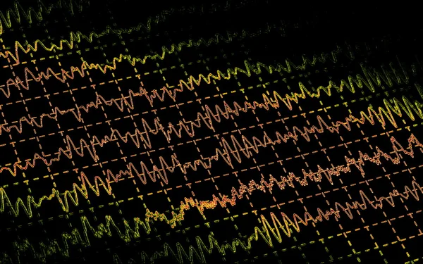 Мозг волны на electroencephalogramme ЭЭГ для epilepsie — стоковое фото